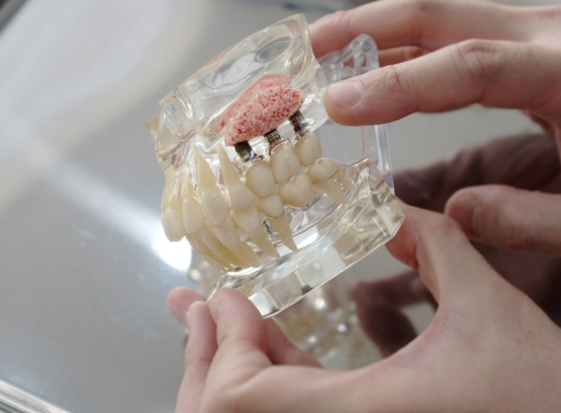 Bone grafting and sinus lift procedures restore jawbone strength for successful dental implants.